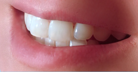 Dentalhygiene